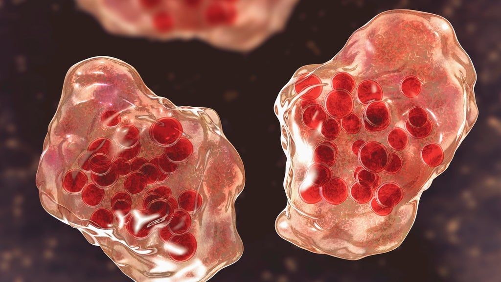 Central Minnesota county reports "several cases of suspected measles" — WCCO / CBS Minnesota, Burnsville Health news
