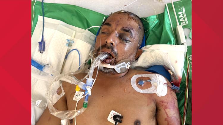 University Hospital asks for help identifying unconscious patient hit by truck Saturday evening — KENS 5 (San Antonio), Burnsville Health news
